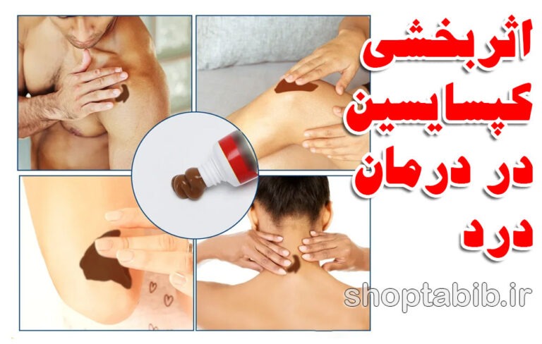 بررسی اثربخشی کپسایسین در کرم‌های ضد درد برای کمردرد عصبی یا سیاتیک