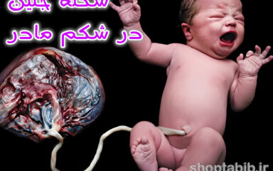 سکته جنین در شکم مادر؛ وقتی هیچ هشدار قبلی نیست