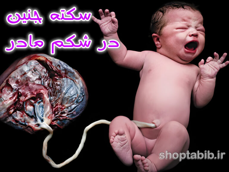 سکته جنین در شکم مادر؛ وقتی هیچ هشدار قبلی نیست