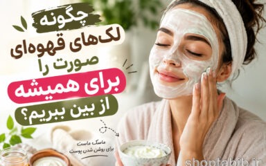 چگونه لک‌های قهوه‌ای صورت را برای همیشه از بین ببریم؟ راهنمای جامع درمان لک صورت