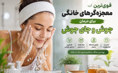 قوی‌ترین معجزه‌گرهای خانگی برای درمان جوش و جای جوش | ۱۵ روش طبیعی