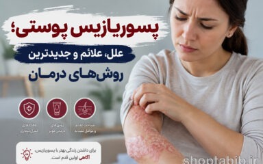 پسوریازیس چیست؟ از علائم و علت تا جدیدترین روش‌های درمان قطعی و کنترل بیماری