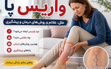 راهنمای جامع واریس پا: علت، علائم و جدیدترین روش‌های درمان