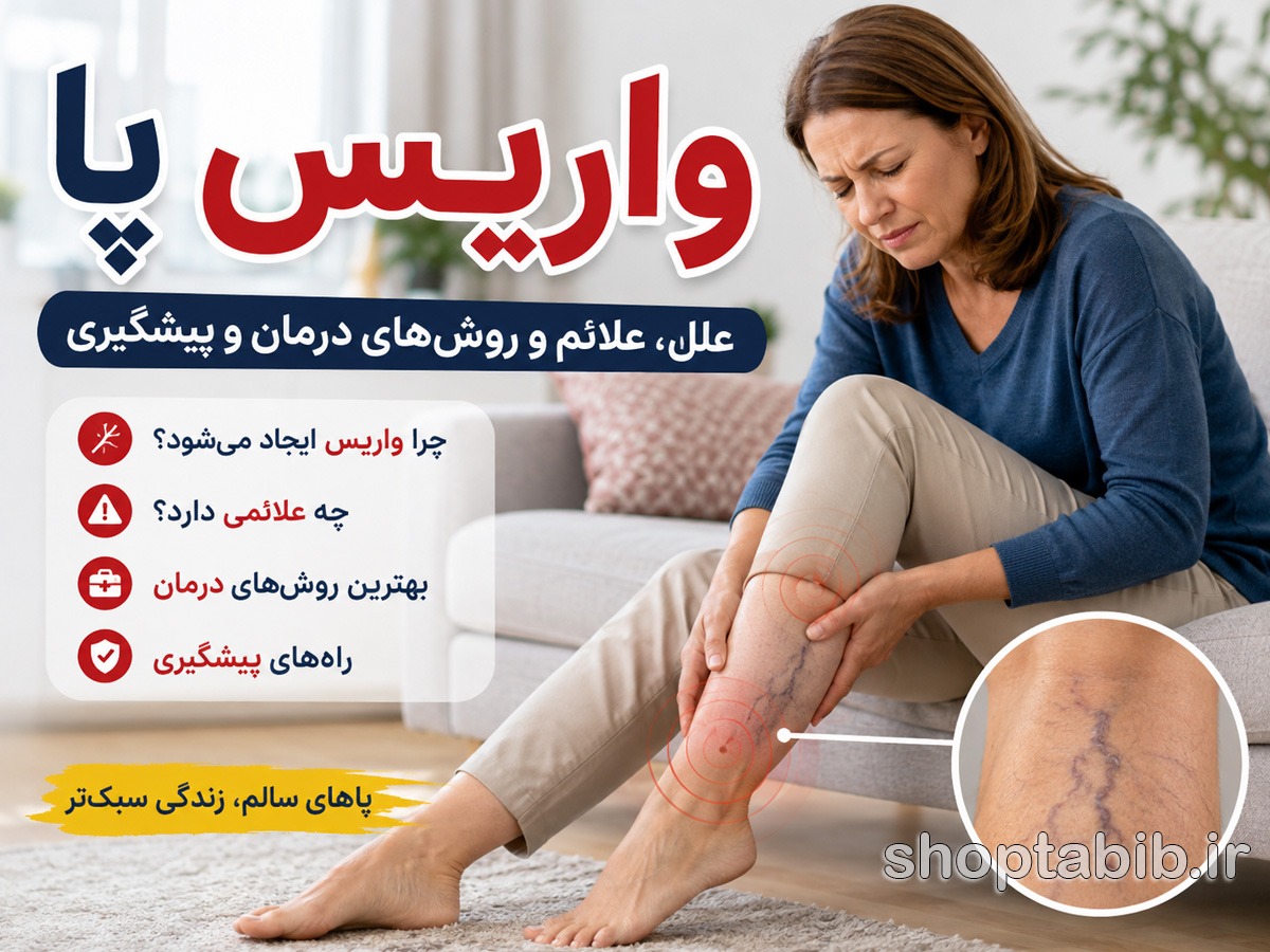 راهنمای جامع واریس پا: علت، علائم و جدیدترین روشهای درمان